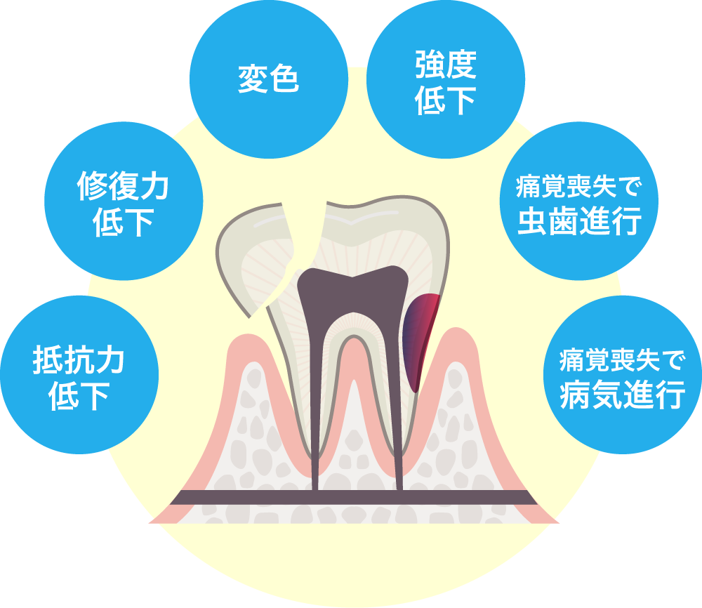 神経を抜いた歯は弱くなる?変色や破折リスクについて解説